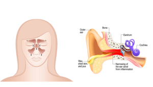 Can Sinus Infection Cause Ear Pain