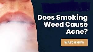 Can Weed Make Your Skin Break Out