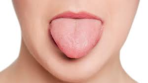 Is A Numb Tongue A Sign Of A Stroke?