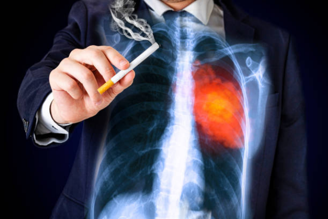 What Causes Lung Cancer