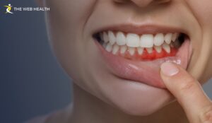 How Long Until a Tooth Infection Kills You