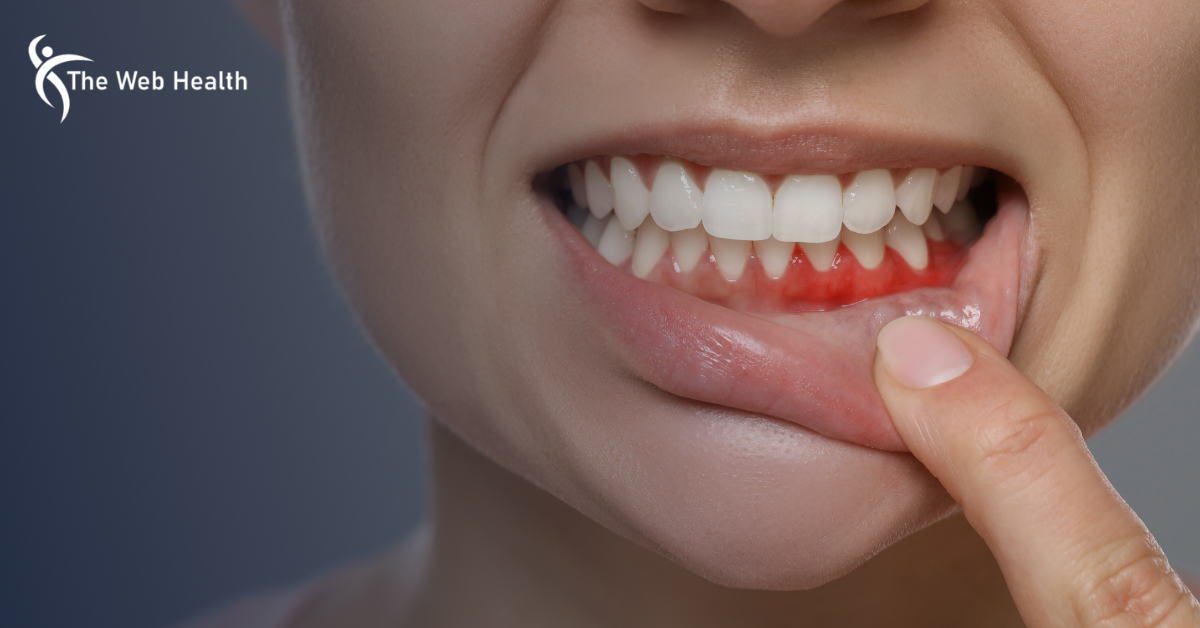 How Long Until a Tooth Infection Kills You