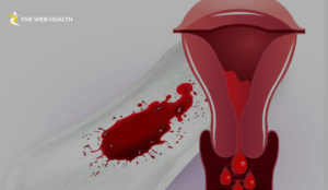 What is Menorrhagia