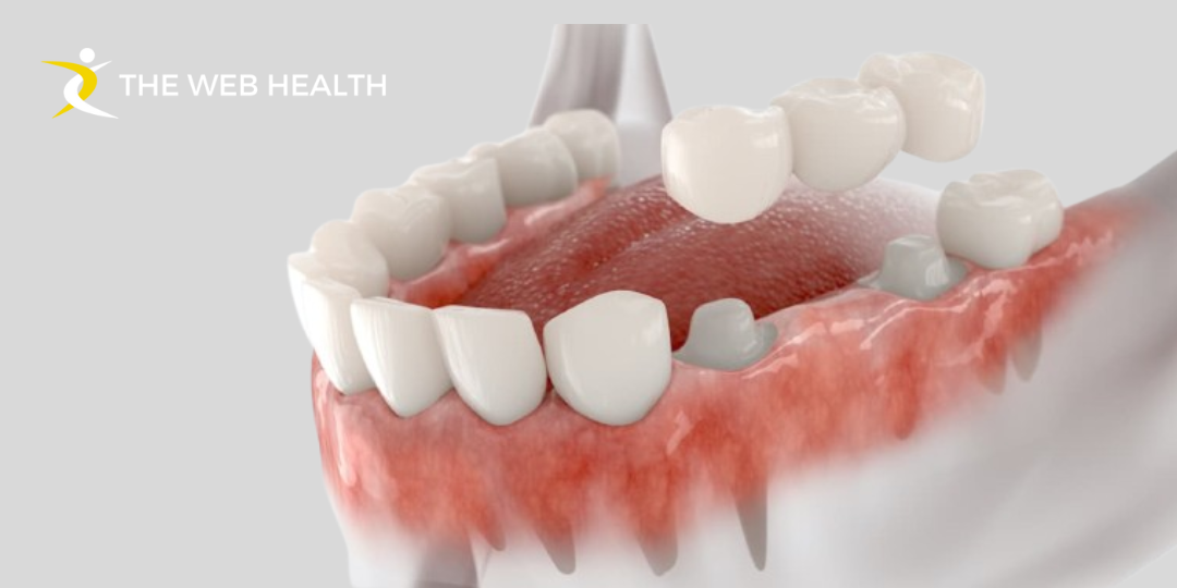 Temporary Crown Pain Causes, Relief & Recovery