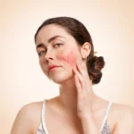 Can amoxicillin cause a skin rashes