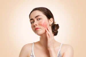 Can amoxicillin cause a skin rashes