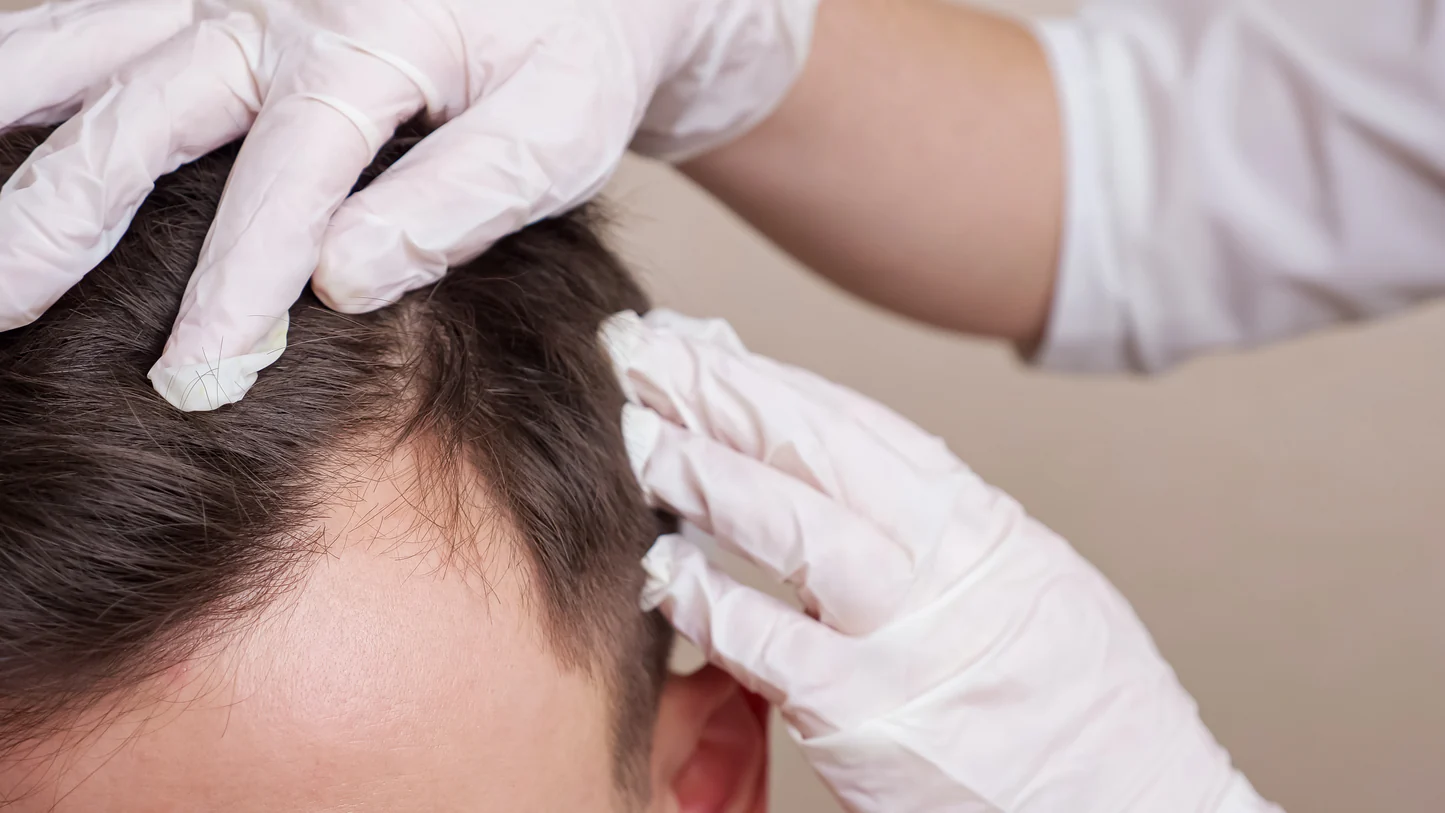 Surprising Hair Facts Every Man Should Know