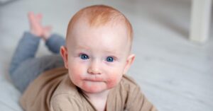 Teething Rash Causes & Treatment You Need to Know